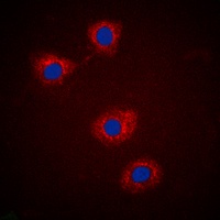 IRS1 (Phospho-S307) Antibody