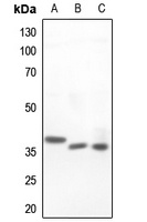 Islet-2 Rabbit Polyclonal Antibody