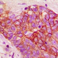 CD29 (Phospho-T789) Antibody