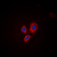 CD29 (Phospho-T789) Antibody