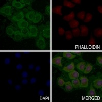 CD61 (Phospho-Y785) Antibody