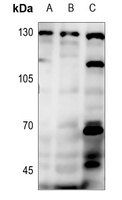 PRKD1/2/3 (Phospho-S738/S742) Rabbit Polyclonal Antibody