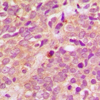 PRKD1/2/3 (Phospho-S738/S742) Rabbit Polyclonal Antibody
