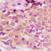 ASK1 (Phospho-S966) Antibody