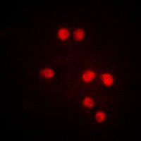 TRAP220 (Phospho-T1457) Antibody