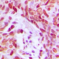 MEF2D (Phospho-S444) Rabbit Polyclonal Antibody