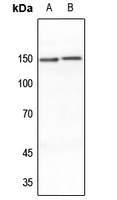 MEKKK6 Antibody
