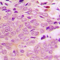 MRPL40 Rabbit Polyclonal Antibody