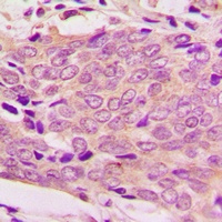 MRPL51 Rabbit Polyclonal Antibody