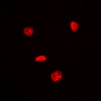 c-Myc Rabbit Polyclonal Antibody