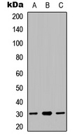 NDUFS3 Rabbit Polyclonal Antibody