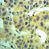 NDUFS3 Rabbit Polyclonal Antibody