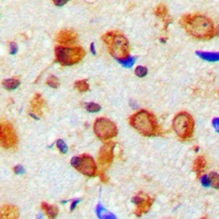 NEFL Rabbit Polyclonal Antibody