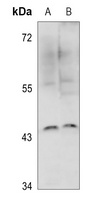IKB epsilon Rabbit Polyclonal Antibody