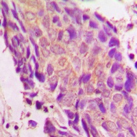 IKB epsilon Rabbit Polyclonal Antibody