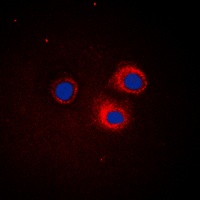 IKB epsilon Rabbit Polyclonal Antibody