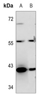 OBCAM Rabbit Polyclonal Antibody
