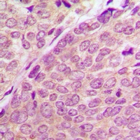PAK1/2/3 (Phospho-S144/141/139) Antibody