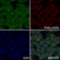 TOPK (Phospho-T9) Antibody