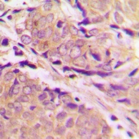 PFKM Rabbit Polyclonal Antibody