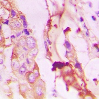 PI3K p85 alpha/p55 gamma (Phospho-Y467/199) Antibody
