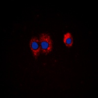 PI3K p85 alpha/p55 gamma (Phospho-Y467/199) Antibody