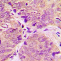 DARPP32 (Phospho-T34) Antibody