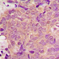 PPT Rabbit Polyclonal Antibody