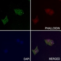 PPT Rabbit Polyclonal Antibody