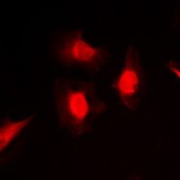 PKC iota/zeta (Phospho-T412/410) Antibody