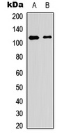 PTP alpha (Phospho-Y798) Rabbit Polyclonal Antibody