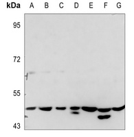 PTX3 Rabbit Polyclonal Antibody