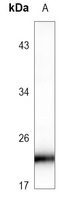 RAB8B Rabbit Polyclonal Antibody