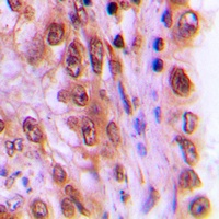 c-Rel (Phospho-S503) Antibody
