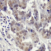 YAP1 (Phospho-S127) Rabbit Polyclonal Antibody