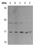 RPS23 Rabbit Polyclonal Antibody