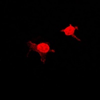 MSK1 (Phospho-S376) Antibody