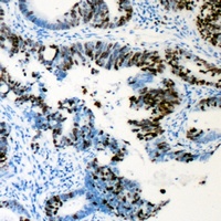 RUNX1 (Phospho-S276) Antibody