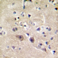 Ryanodine Receptor 2 Rabbit Polyclonal Antibody