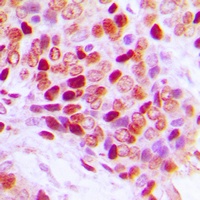 SF1 (Phospho-S82) Antibody
