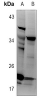 Alpha-synuclein Rabbit Polyclonal Antibody