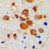 Tyrosine Hydroxylase (Phospho-S19) Antibody