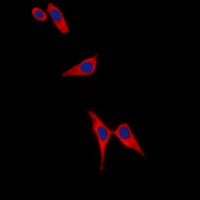 Tyrosine Hydroxylase (Phospho-S19) Antibody