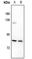 UTP14A Rabbit Polyclonal Antibody