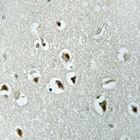 UTP14A Rabbit Polyclonal Antibody
