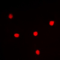 UTP14A Rabbit Polyclonal Antibody
