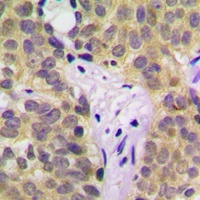 SGK1 (Phospho-S422) Antibody