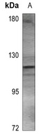 ACLY Rabbit Polyclonal Antibody