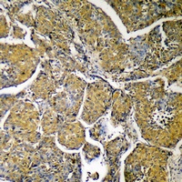 ACLY Rabbit Polyclonal Antibody