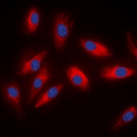 ACLY Rabbit Polyclonal Antibody